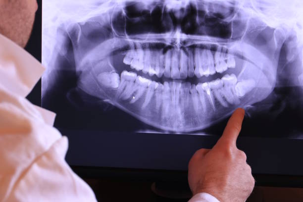 Best Knocked-Out Tooth (Avulsed Tooth) Treatment in Jacksonville, NC