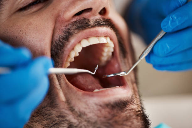 Best Emergency Treatment for Oral Infections in Jacksonville, NC