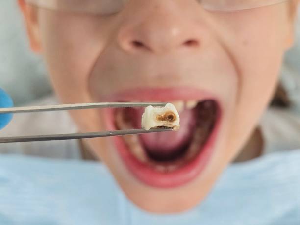 Best Walk-In Emergency Dental Services in Jacksonville, NC